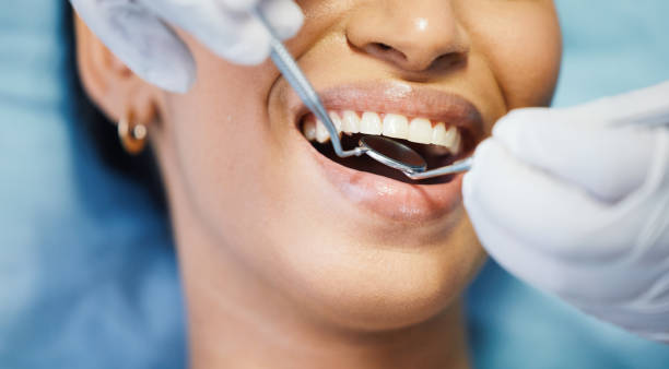 Best Emergency Wisdom Teeth Removal in Little Flock, AR