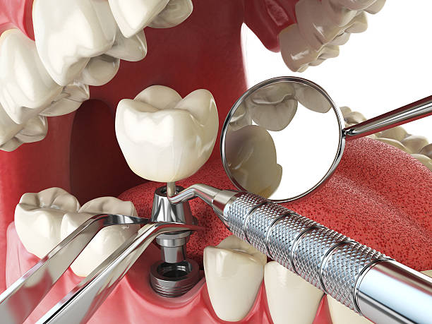 Best Emergency Root Canal Treatment in Little Flock, AR